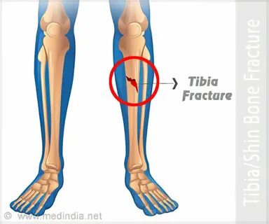 Latest On Tibia