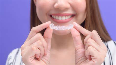 Who Aligns the Aligners?