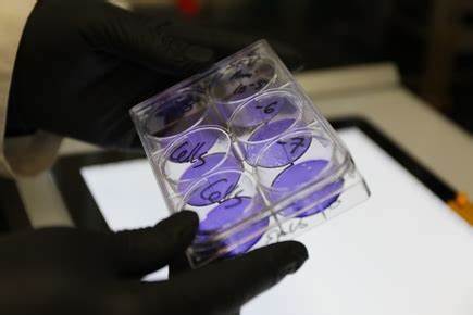 Review suggests ending adult boosters for tetanus, diphtheria