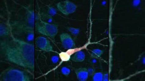 Scientists can now target the cells at the center of ALS