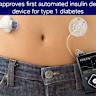 Medtronic names CFO for diabetes spinoff