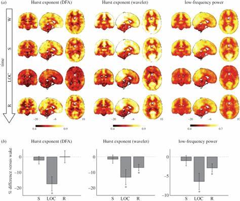 The search for a universal signature of unconsciousness