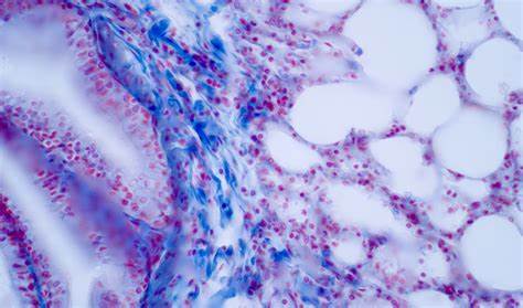 Helmholtz Munich & Parse Biosciences Create Largest Lung Atlas