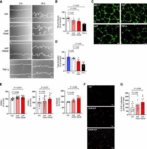 Imidazole propionate is a driver and therapeutic target in atherosclerosis
