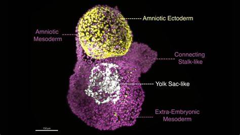 Mini amniotic sacs in the lab using stem cells
