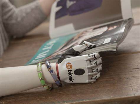 Neue Handprothese wird mit Magneten gesteuert