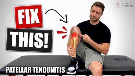 How AI Is Fixing My Patellar Tendonitis