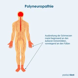 Polyneuropathie – Symptome und Behandlung | praktischArzt