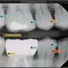 Pearl Launches Imagecheck AI for Real-Time Dental X-ray QA