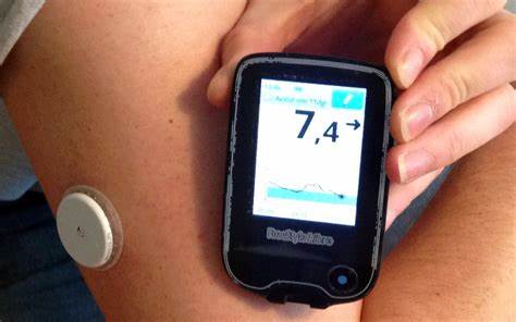 Senzori de monitorizare continuă a glicemiei - Diabet zaharat