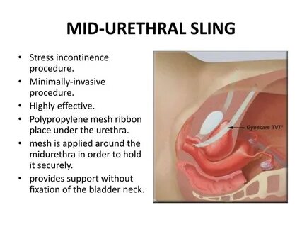 Vorschusszinsen: Definition und Berechnung - Kredite.org