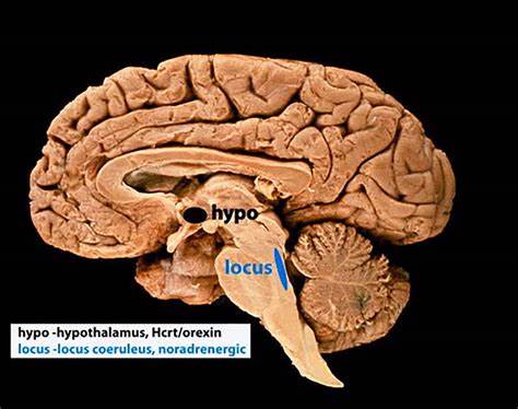 Scientists unravel how a tiny brain region helps us form distinct memories
