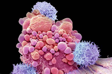 Cancer-Killing Immune Cells Can Now Be Engineered in the Body