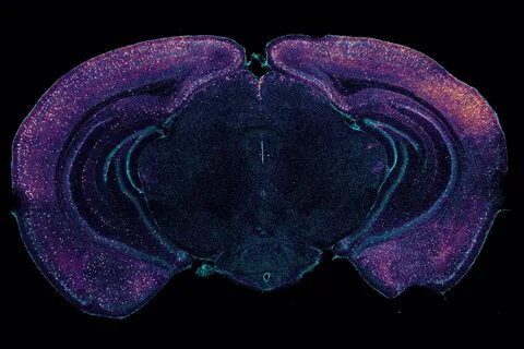 In Down syndrome mice, 40Hz light and sound improve cognition