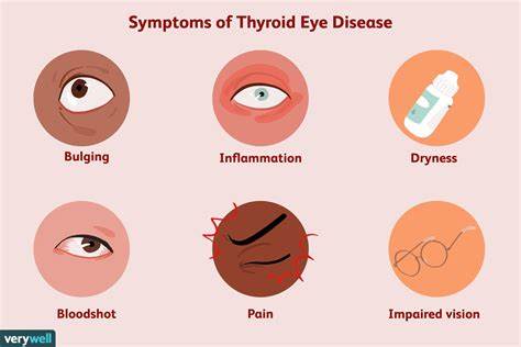 Viridian Therapeutics Announces Positive Topline Results from Veligrotug Phase 3 THRIVE-2 Clinical Trial in Patients with Chronic Thyroid Eye Disease - Yahoo Finance