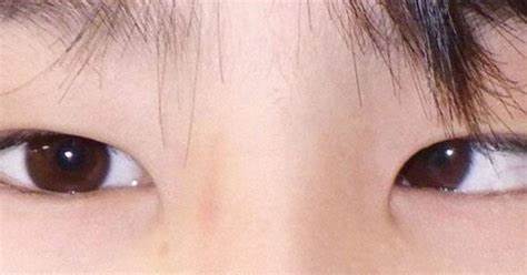 Japan focusing on fix for smart-phone related eye condition