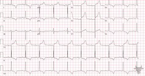 Configuring Subdomains in Development with Lvh.me