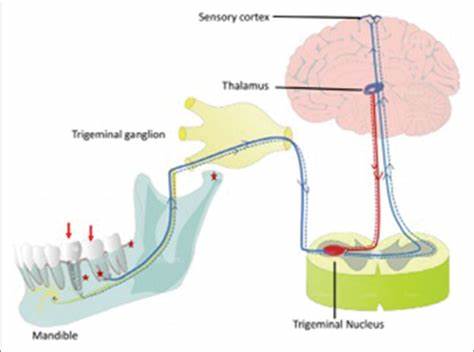 Considerations towards inducing proprioceptive feedback in dental implants