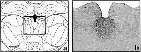 Paraventricular Thalamus in Alcohol Seeking Rats with Withdrawal