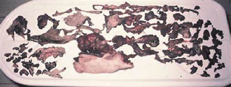 Total Body Disruption