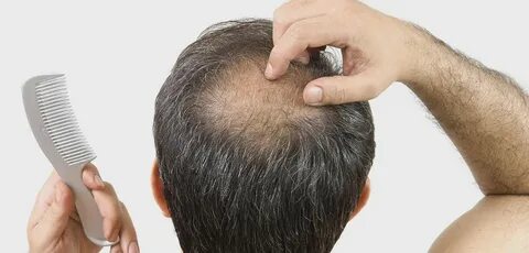 Can This $860 Helmet Fix Your Hair Loss?
