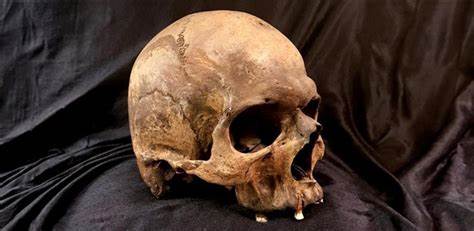 Large-scale DNA study maps 37,000 years of human disease history