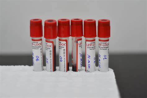 Mysterious Antibody in French Woman's Body. Turned Out to Be New Blood Type