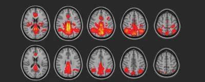 Non-Concussive Head Impacts and Brain Microstructure, Chemistry and Function