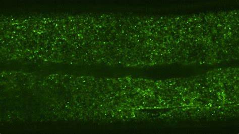 Worms reveal just how cramped cells really are