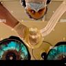 General Anesthesia