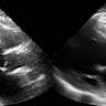 Ultrasound triggers nuclear decay anomaly hinting at flexible space-time