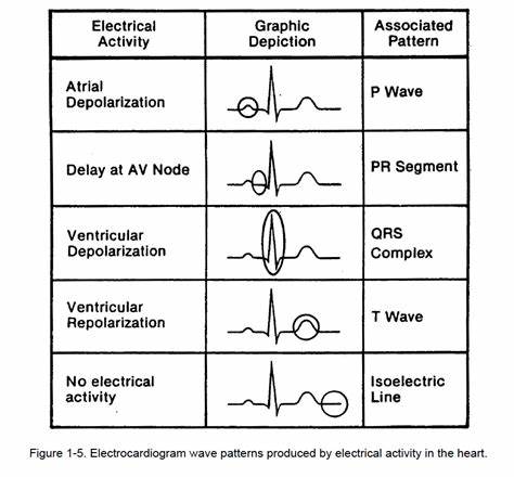 Activity Type Effects Signal Quality in Electrocardiogram Devices