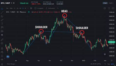 🚨 XRP Price Alert! 🚨 Head and Shoulders Pattern Spotted! 🐻📉 - Binance