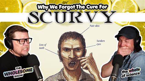 The Cure for Scurvy, Forgotten