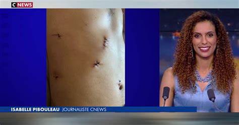 Une journaliste de CNEWS agressée dans le tramway - JForum