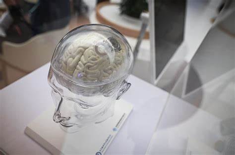 China pours money into brain chips that give paralysed people more control