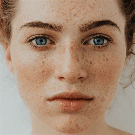 Reason so many people seem to have the exact same freckle