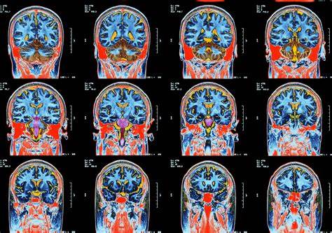 People's brains aged faster during the Covid pandemic – even the uninfected