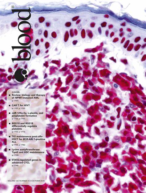 NPM1-mutated acute myeloid leukemia: from bench to bedside