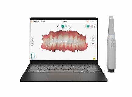 DEXIS™ Unveils Imprevo Scanner Powered by IS ScanFlow Innovation