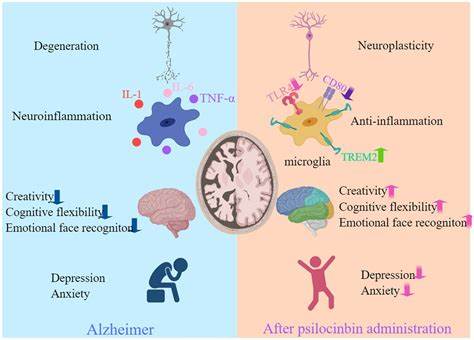 Psychedelics and Alzheimer's Disease