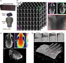 Fourier lightfield multiview stereoscope for large field-of-view 3D imaging