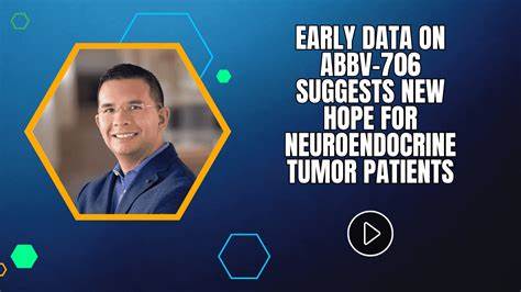 Teva’s Ajovy Shows Sustained Long-Term Efficacy in Migraine Prevention Trial