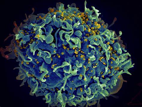 The First Widespread Cure for HIV Could Be in Children
