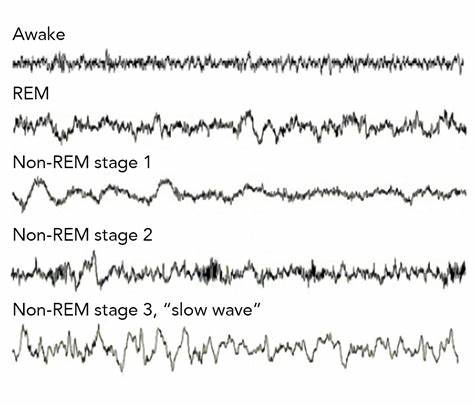 Signature 'Wave' of Activity as the Brain Awakens from Sleep