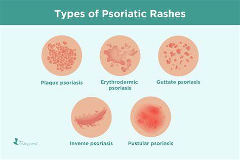 Can I Have Both Psoriatic Arthritis and Rheumatoid Arthritis?