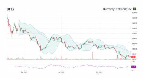 Butterfly Network, Inc. (BFLY) Gains Analyst Confidence Amid EU Review