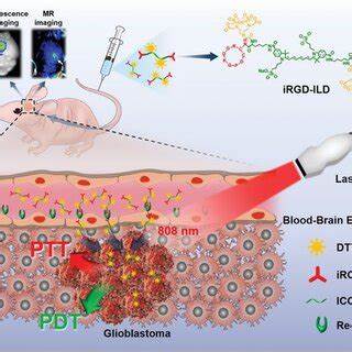 Near-infrared fatty acid molecular probe in image-guided surgery of glioblastoma
