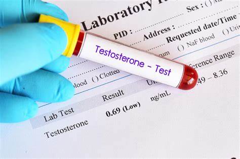 Anti-obesity medications can normalize testosterone levels in men