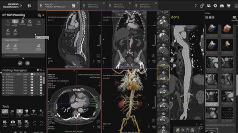 Rendering CT scan animations in the cloud